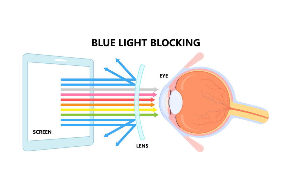 Do Blue Light Glasses Help Dry Eyes?