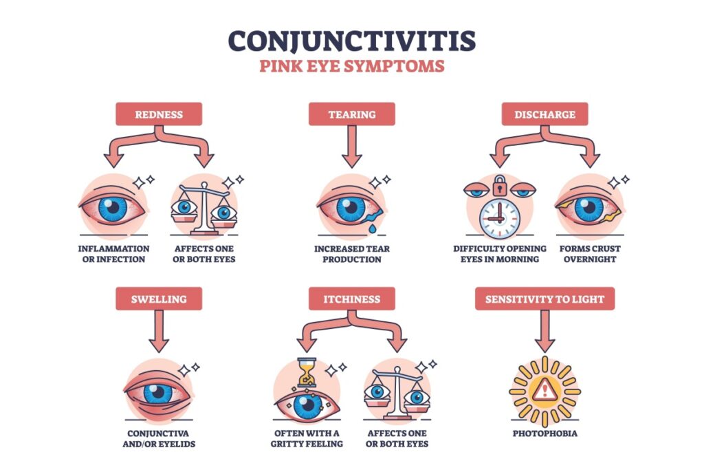 Infographic illustrating common conjunctivitis symptoms including redness, tearing, discharge, swelling, itchiness, and sensitivity to light.